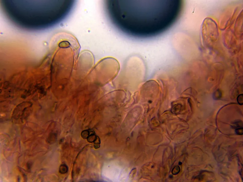 Agaricus moelleri 10 - Queilocistidios